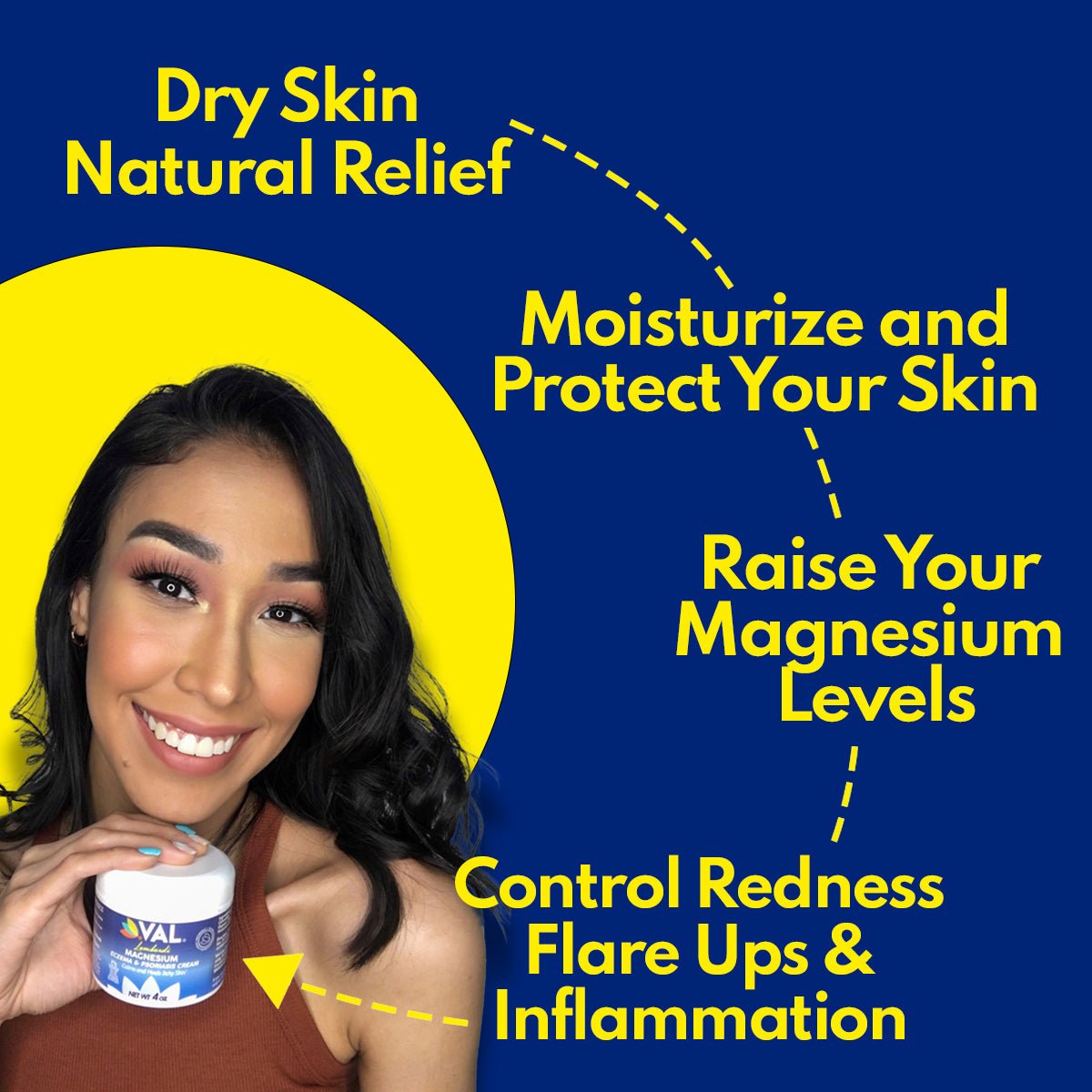 VAL Lombardi Magnesium Chloride Formula - Eczema, Psoriasis, Anti Itch Cream, Moisturizer - 4oz - Val Supplements